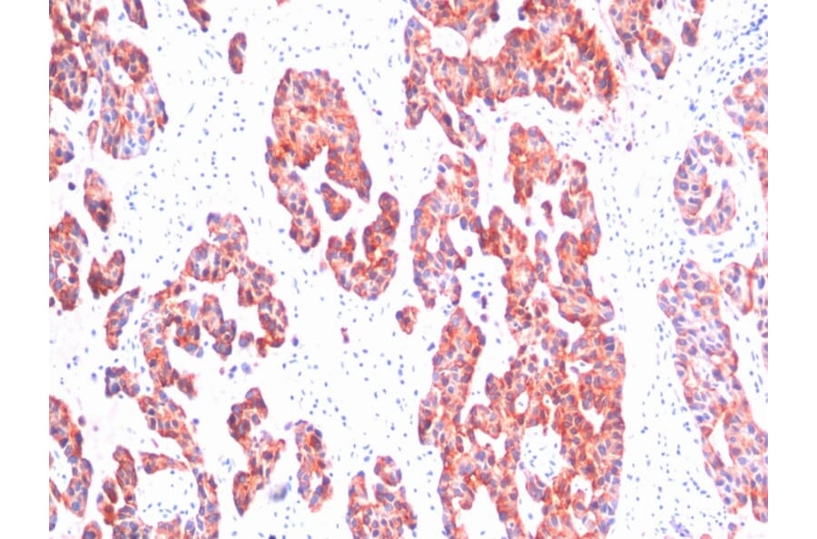 Immunohistochemistry - Anti-Keratin 76 Antibody [SPM116] - BSA and Azide free (A254167) - Antibodies.com