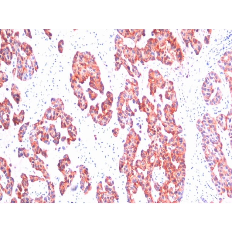 Immunohistochemistry - Anti-Keratin 76 Antibody [SPM116] - BSA and Azide free (A254167) - Antibodies.com