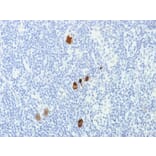 Immunohistochemistry - Anti-EBV LMP-1 Antibody [CS1-4] - BSA and Azide free (A254168) - Antibodies.com