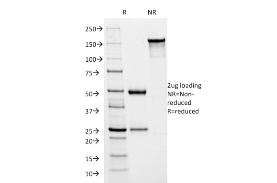 SDS-PAGE - Anti-HSV1 ICP8 Antibody [HSVI/2045] - BSA and Azide free (A254170) - Antibodies.com