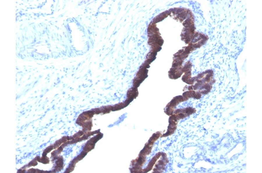 Immunohistochemistry - Anti-Cytokeratin 8 + 18 Antibody [K8.8 + DC10] - BSA and Azide free (A254172) - Antibodies.com
