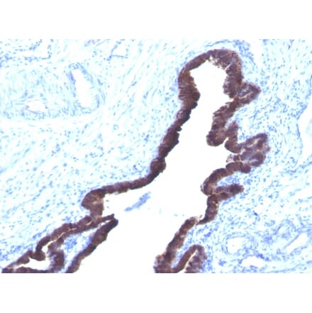 Immunohistochemistry - Anti-Cytokeratin 8 + 18 Antibody [K8.8 + DC10] - BSA and Azide free (A254172) - Antibodies.com