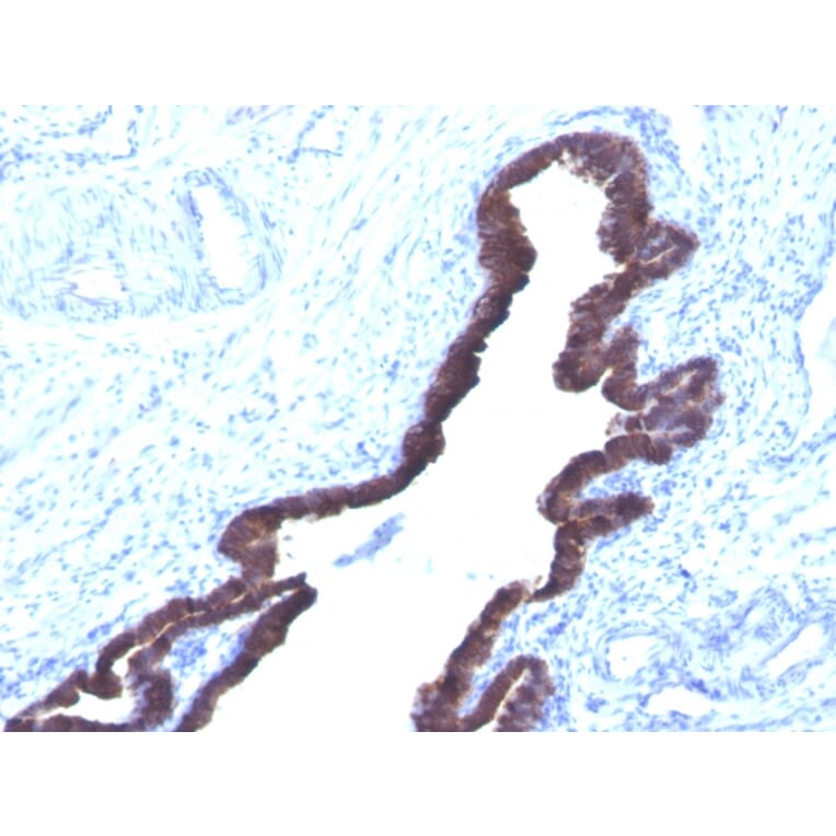 Immunohistochemistry - Anti-Cytokeratin 8 + 18 Antibody [K8.8 + DC10] - BSA and Azide free (A254172) - Antibodies.com