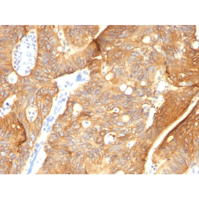 Immunohistochemistry - Anti-Cytokeratin 8 + 18 Antibody [K8.8 + DC10] - BSA and Azide free (A254171) - Antibodies.com