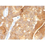 Immunohistochemistry - Anti-Cytokeratin 8 + 18 Antibody [K8.8 + DC10] - BSA and Azide free (A254171) - Antibodies.com