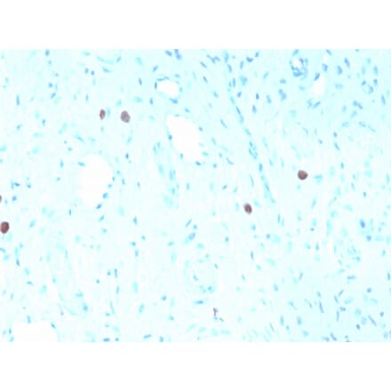 Immunohistochemistry - Anti-HPV16 L1 Antibody [rHPV16L1/1058] - BSA and Azide free (A254176) - Antibodies.com