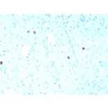 Immunohistochemistry - Anti-HPV16 L1 Antibody [rHPV16L1/1058] - BSA and Azide free (A254176) - Antibodies.com