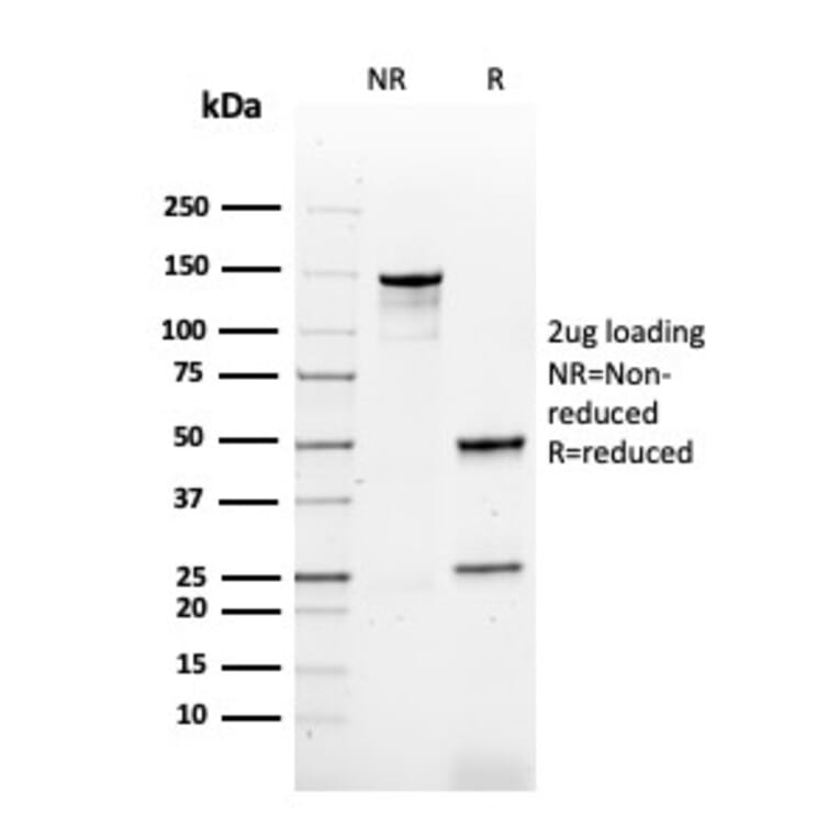 SDS-PAGE - Anti-HPV16 L1 Antibody [rHPV16L1/1058] - BSA and Azide free (A254177) - Antibodies.com