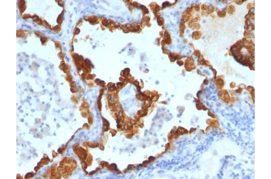 Immunohistochemistry - Anti-Cytokeratin 8 + 18 Antibody [C-43 + DC10] - BSA and Azide free (A250999) - Antibodies.com