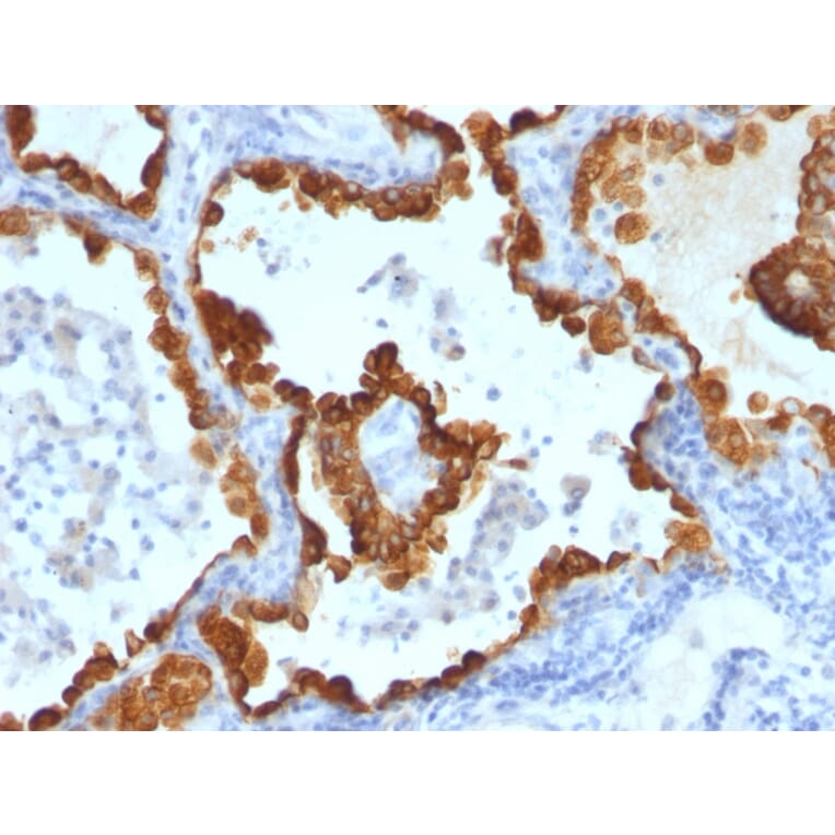 Immunohistochemistry - Anti-Cytokeratin 8 + 18 Antibody [C-43 + DC10] - BSA and Azide free (A250999) - Antibodies.com