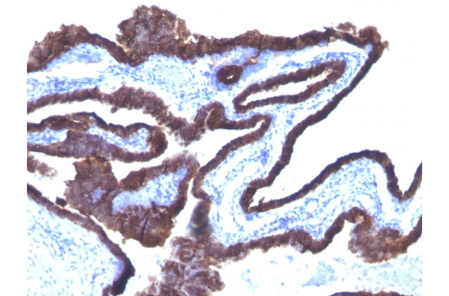 Immunohistochemistry - Anti-Cytokeratin 8 + 18 Antibody [C-43 + DC10] - BSA and Azide free (A250999) - Antibodies.com