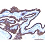 Immunohistochemistry - Anti-Cytokeratin 8 + 18 Antibody [C-43 + DC10] - BSA and Azide free (A250999) - Antibodies.com