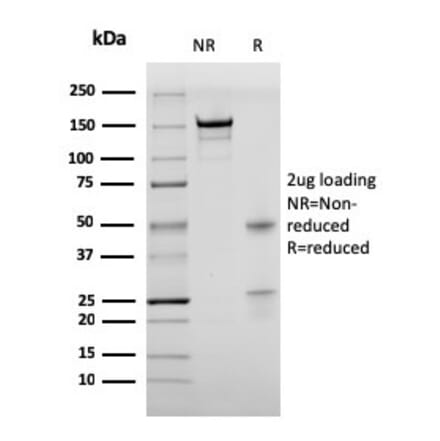 SDS-PAGE - Anti-BrdU Antibody [rBRD469] - BSA and Azide free (A254179) - Antibodies.com