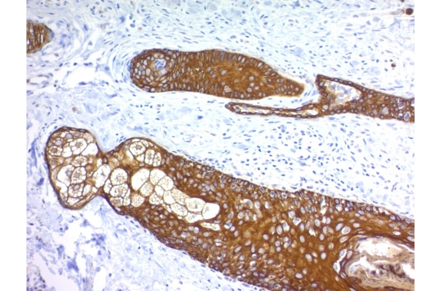 Immunohistochemistry - Anti-Keratin 76 Antibody [KRTH/1076] - BSA and Azide free (A254180) - Antibodies.com