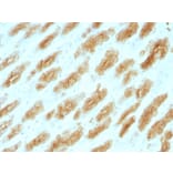 Immunohistochemistry - Anti-Keratin 76 Antibody [KRTH/1076] - BSA and Azide free (A254181) - Antibodies.com