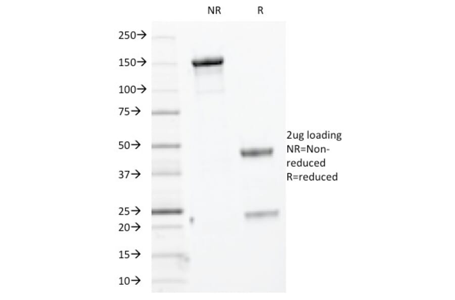 SDS-PAGE - Anti-Keratin 76 Antibody [KRTH/1076] - BSA and Azide free (A254181) - Antibodies.com