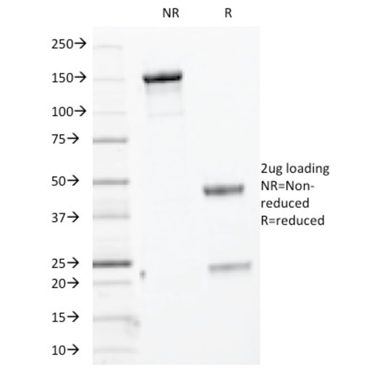 SDS-PAGE - Anti-Keratin 76 Antibody [KRTH/1076] - BSA and Azide free (A254181) - Antibodies.com