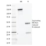 SDS-PAGE - Anti-Keratin 76 Antibody [KRTH/1076] - BSA and Azide free (A254181) - Antibodies.com