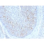 Immunohistochemistry - Anti-HPV16 E1 + E4 Antibody [HPV16 E1/E4] - BSA and Azide free (A254182) - Antibodies.com