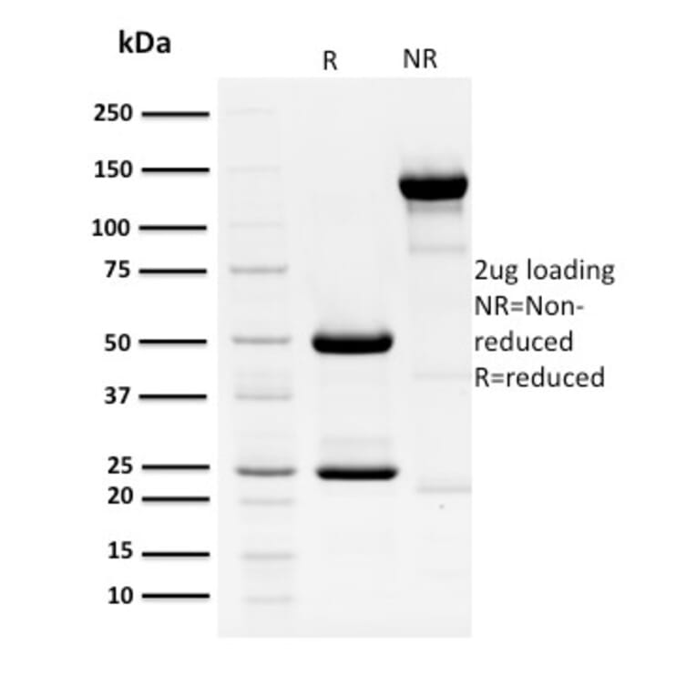 SDS-PAGE - Anti-HPV16 E1 + E4 Antibody [HPV16 E1/E4] - BSA and Azide free (A254182) - Antibodies.com