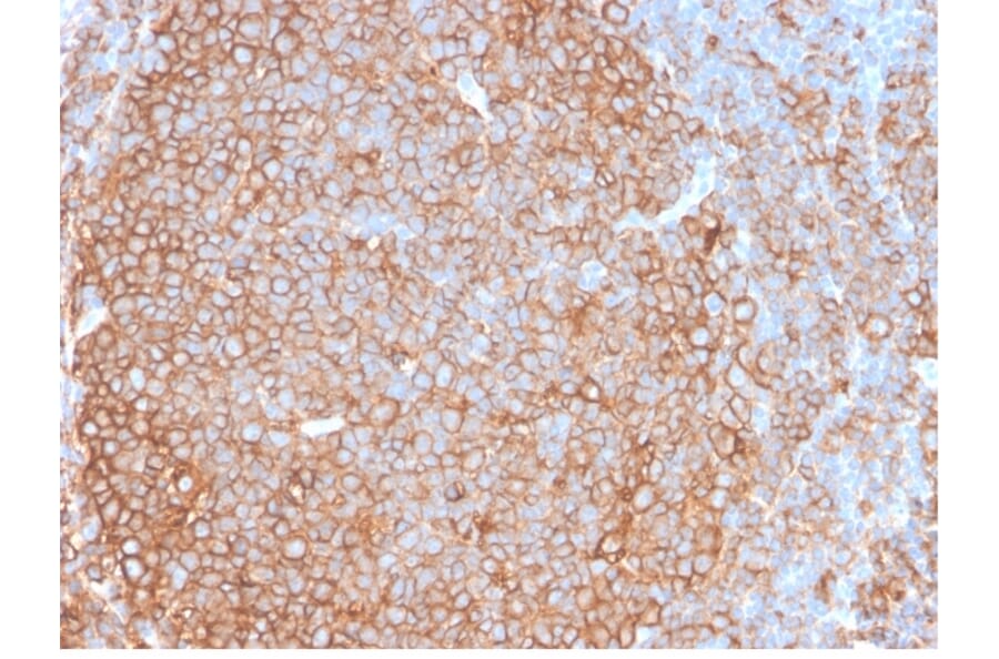 Immunohistochemistry - Anti-HLA DP + DQ + DR Antibody [HLA-Pan/2967R] - BSA and Azide free (A254185) - Antibodies.com