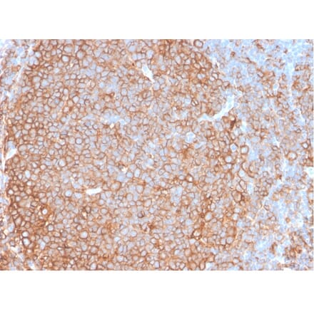 Immunohistochemistry - Anti-HLA DP + DQ + DR Antibody [HLA-Pan/2967R] - BSA and Azide free (A254185) - Antibodies.com
