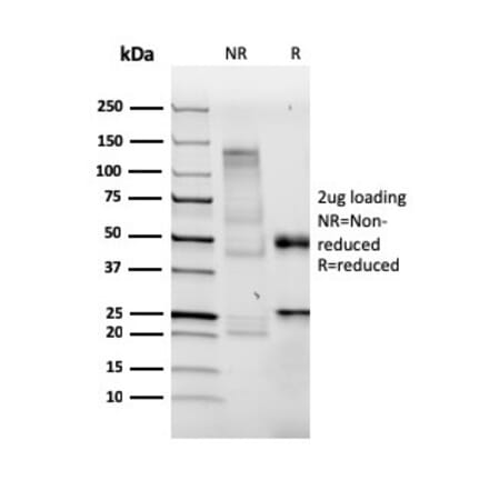 SDS-PAGE - Anti-BrdU Antibody [BRDU/3902R] - BSA and Azide free (A254185) - Antibodies.com