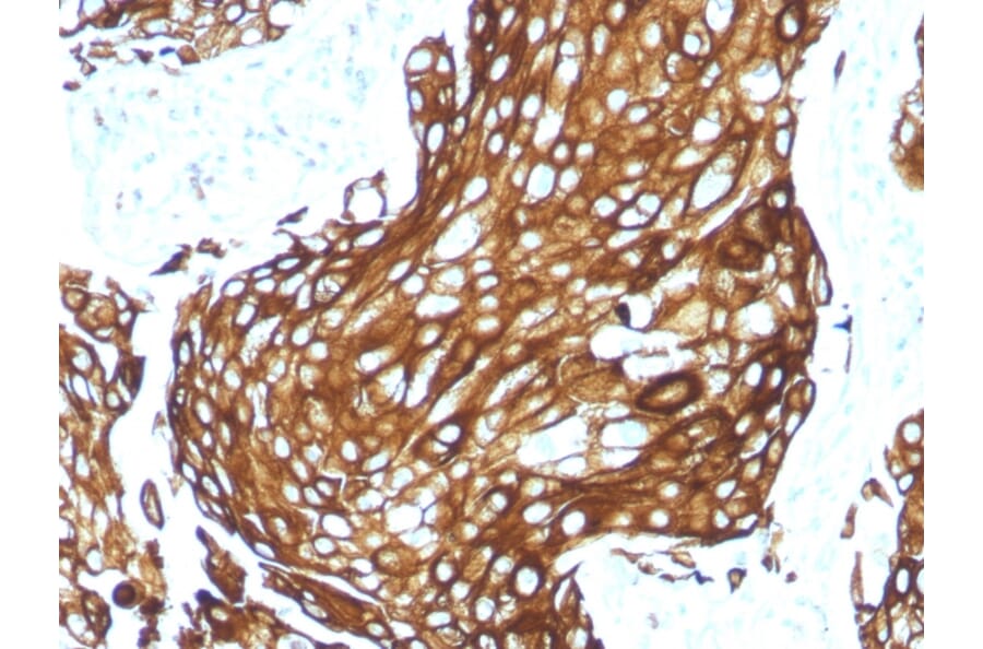 Immunohistochemistry - Anti-Keratin 77 Antibody [KRTL/1577R] - BSA and Azide free (A254186) - Antibodies.com