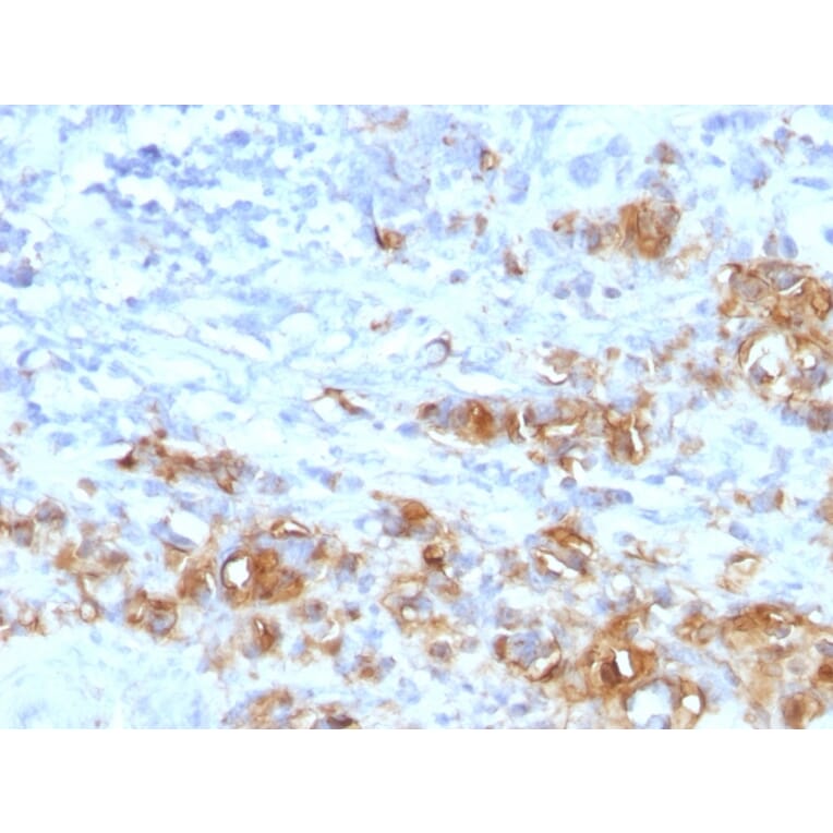 Immunohistochemistry - Anti-CA19-9 Antibody [CA19.9/1390R] - BSA and Azide free (A254187) - Antibodies.com