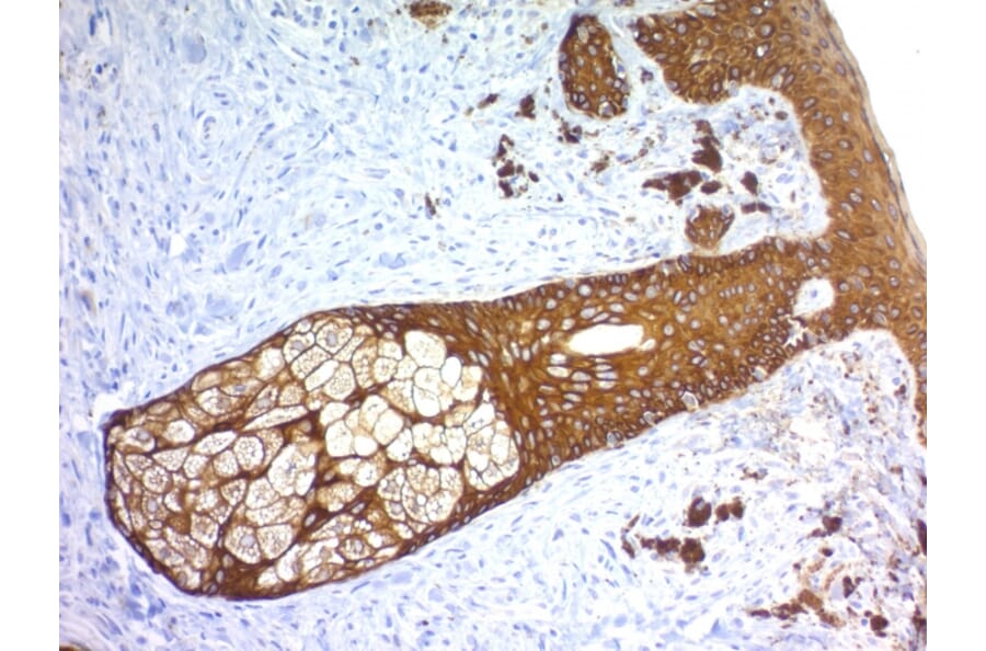 Immunohistochemistry - Anti-Keratin 76 Antibody [KRTH/1576R] - BSA and Azide free (A254190) - Antibodies.com