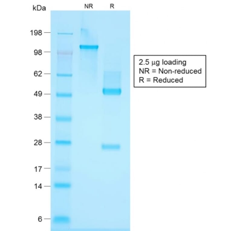 SDS-PAGE - Anti-Keratin 76 Antibody [KRTH/1576R] - BSA and Azide free (A254190) - Antibodies.com