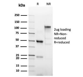 SDS-PAGE - Anti-His Tag Antibody [6HIS/6402R] - BSA and Azide free (A254191) - Antibodies.com