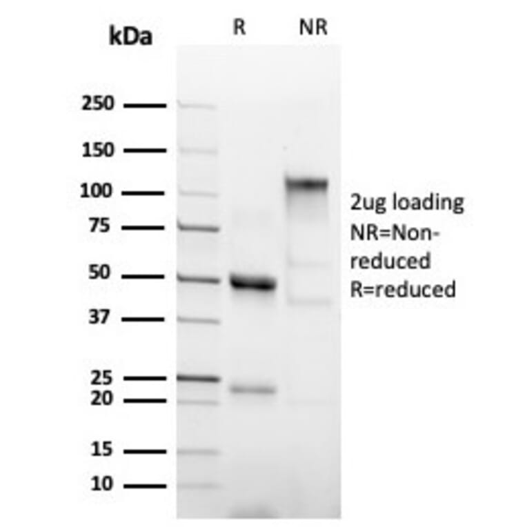 SDS-PAGE - Anti-His Tag Antibody [6HIS/6402R] - BSA and Azide free (A254191) - Antibodies.com