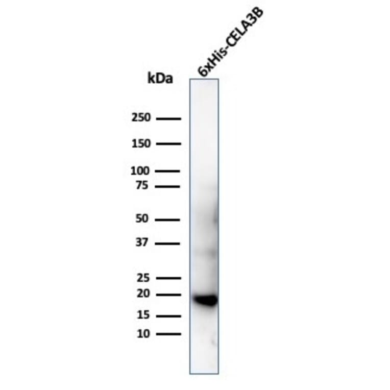 Western Blot - Anti-His Tag Antibody [6HIS/6402R] - BSA and Azide free (A254192) - Antibodies.com