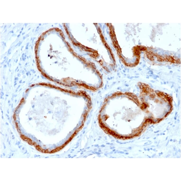Immunohistochemistry - Anti-Keratin 76 Antibody [KRTH/2147R] - BSA and Azide free (A251014) - Antibodies.com