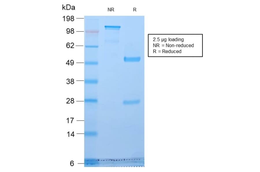 SDS-PAGE - Anti-Golgi Complex Antibody [GLG1/2829R] - BSA and Azide free (A254194) - Antibodies.com