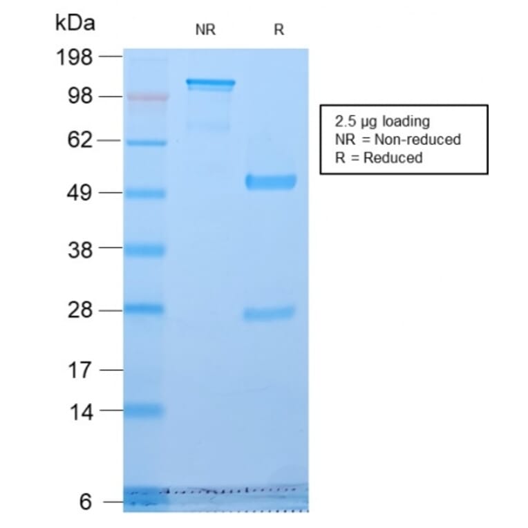 SDS-PAGE - Anti-Golgi Complex Antibody [GLG1/2829R] - BSA and Azide free (A254194) - Antibodies.com