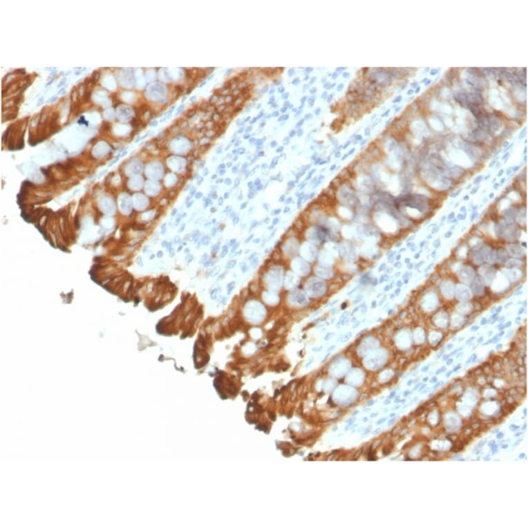 Immunohistochemistry - Anti-Cytokeratin 8 + 18 Antibody [KRT8.18/2297R] - BSA and Azide free (A254194) - Antibodies.com