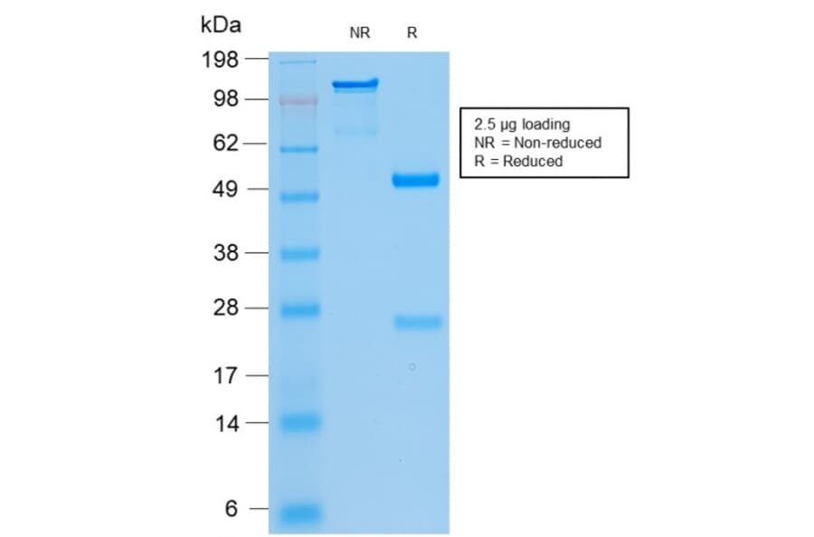 SDS-PAGE - Anti-Cytokeratin 8 + 18 Antibody [KRT8.18/2297R] - BSA and Azide free (A254195) - Antibodies.com