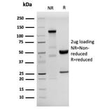 SDS-PAGE - Anti-HHV8 LNA-1 Antibody [HHV8/3633R] - BSA and Azide free (A254196) - Antibodies.com