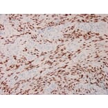 Immunohistochemistry - Anti-HHV8 LNA-1 Antibody [HHV8/3633R] - BSA and Azide free (A254195) - Antibodies.com
