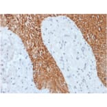 Immunohistochemistry - Anti-pan Cytokeratin Antibody [KRT/1877R] - BSA and Azide free (A254197) - Antibodies.com