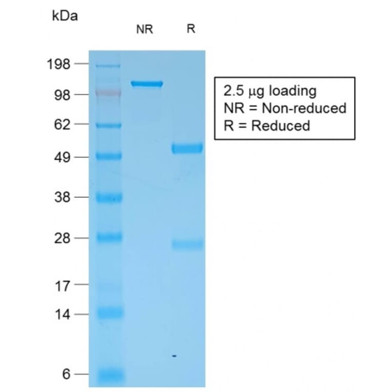 SDS-PAGE - Anti-pan Cytokeratin Antibody [KRT/1877R] - BSA and Azide free (A254197) - Antibodies.com