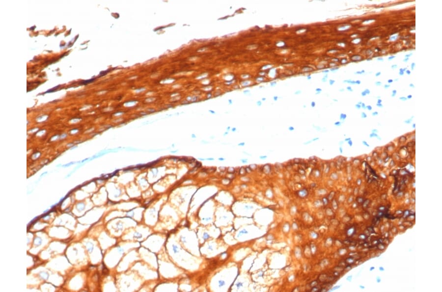 Immunohistochemistry - Anti-Keratin 76 Antibody [KRTH/4392R] - BSA and Azide free (A254198) - Antibodies.com