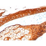 Immunohistochemistry - Anti-Keratin 76 Antibody [KRTH/4392R] - BSA and Azide free (A254198) - Antibodies.com