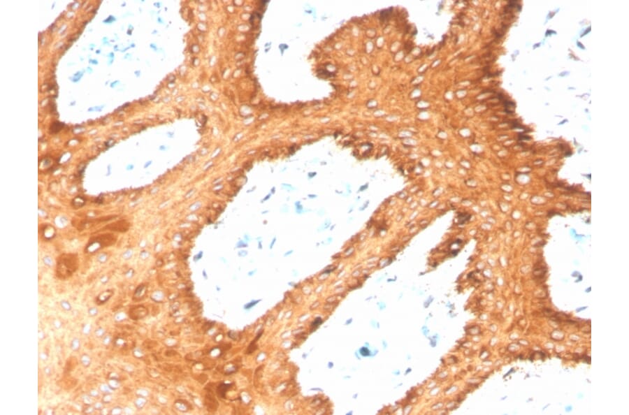 Immunohistochemistry - Anti-Keratin 76 Antibody [KRTH/4392R] - BSA and Azide free (A251019) - Antibodies.com