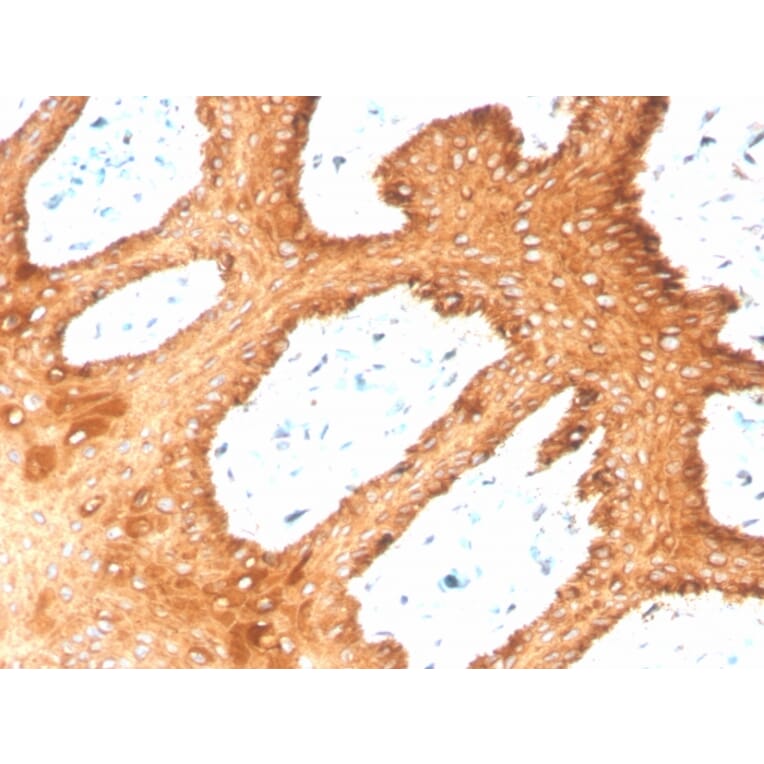 Immunohistochemistry - Anti-Keratin 76 Antibody [KRTH/4392R] - BSA and Azide free (A251019) - Antibodies.com
