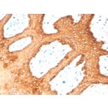 Immunohistochemistry - Anti-Keratin 76 Antibody [KRTH/4392R] - BSA and Azide free (A251019) - Antibodies.com