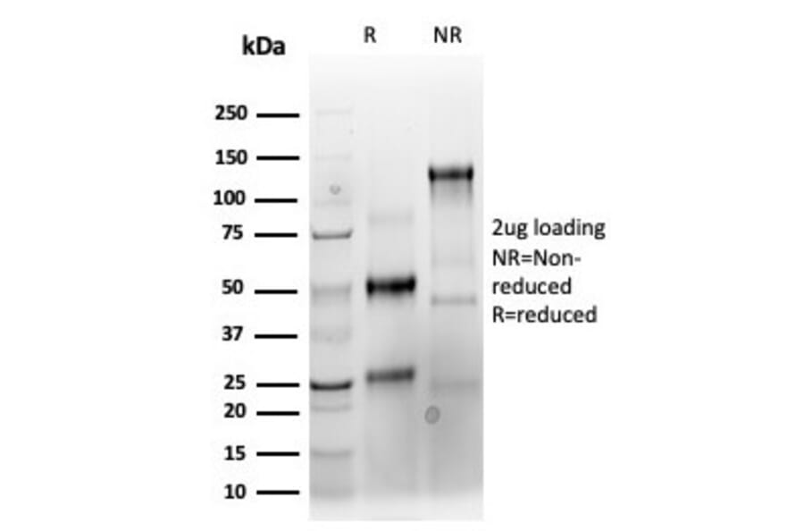 SDS-PAGE - Anti-Keratin 76 Antibody [KRTH/4392R] - BSA and Azide free (A251019) - Antibodies.com