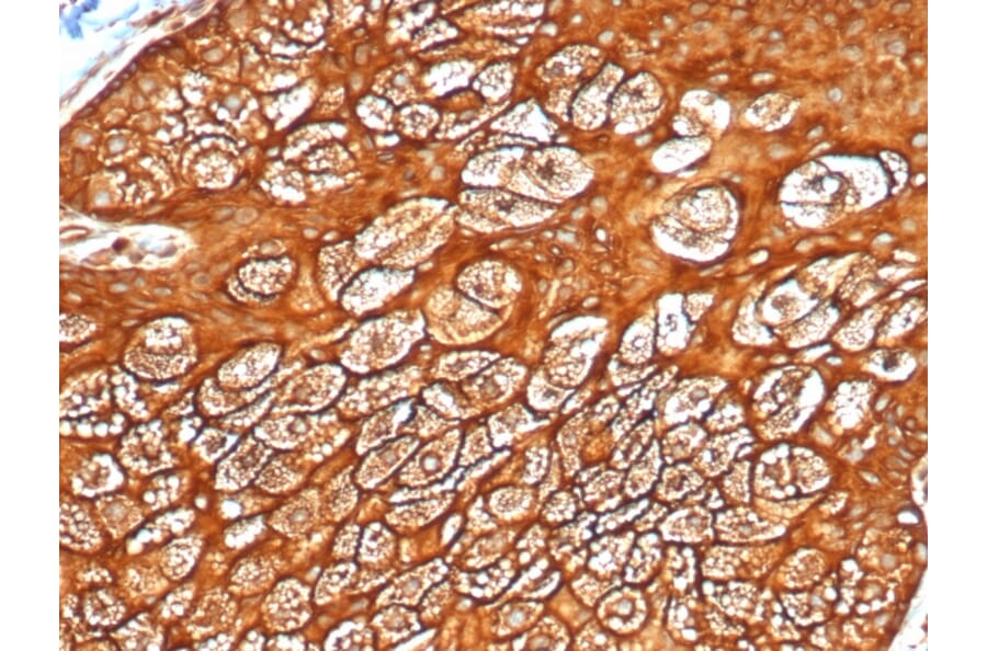 Immunohistochemistry - Anti-Keratin 77 Antibody [KRTL/4440R] - BSA and Azide free (A254199) - Antibodies.com